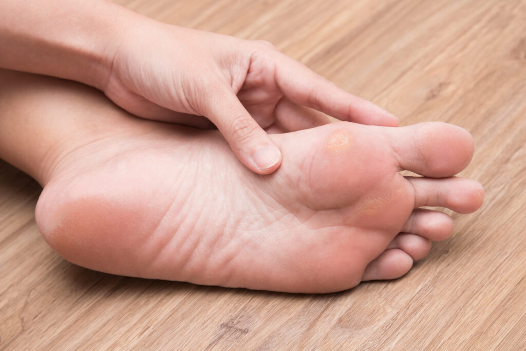 Your Summer Guide to At-Home Foot Care